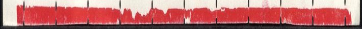 Image:ddr0340vXI.1js.small_rlu1.jpg